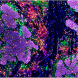 单细胞测序+多色免疫荧光