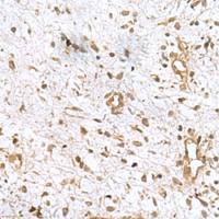 兔抗AK6多克隆抗体