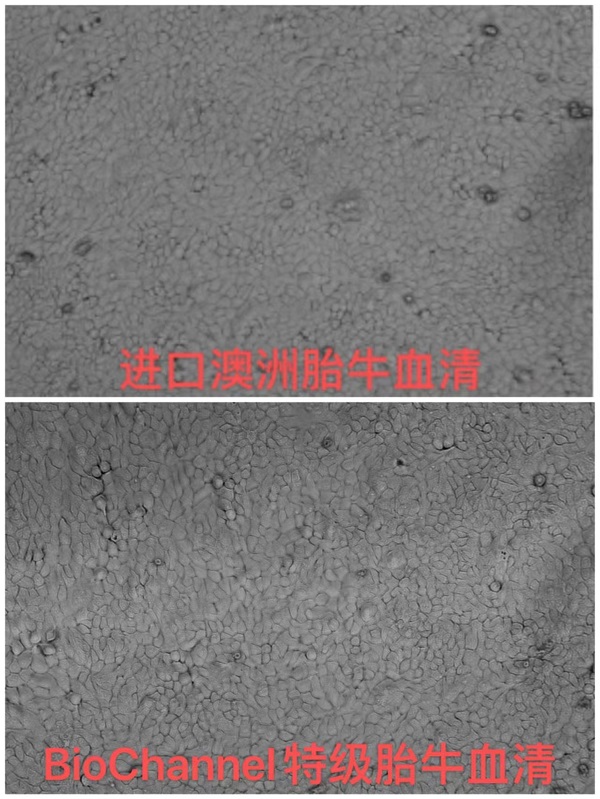 细胞培养时添加血清的作用是什么？