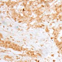 兔抗MOB1B多克隆抗体