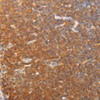 兔抗SRC多克隆抗体