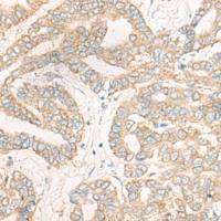 兔抗DEPTOR多克隆抗体