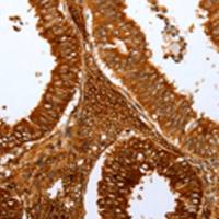 兔抗FOXN1 多克隆抗体