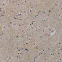 兔抗ROBO4多克隆抗体