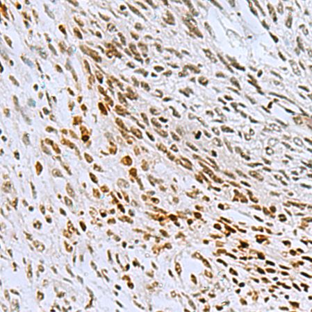 兔抗CNOT7多克隆抗体