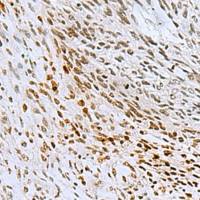 兔抗CNOT7多克隆抗体