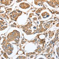 兔抗CAPG多克隆抗体