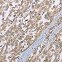 兔抗ECHS1多克隆抗体