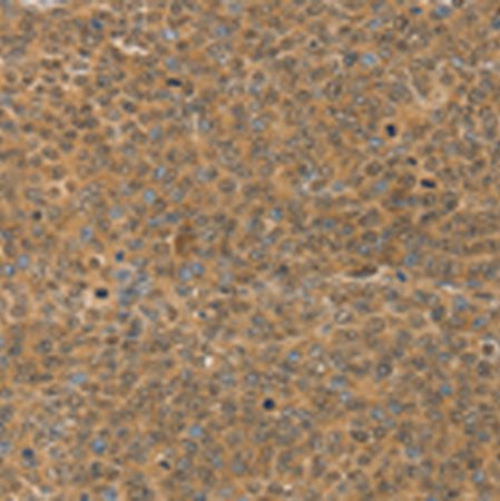 兔抗MED15多克隆抗体