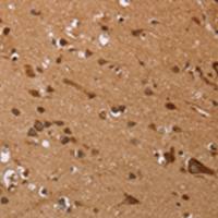 兔抗EDN3多克隆抗体