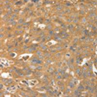 兔抗CALR多克隆抗体