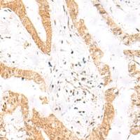 兔抗HES7多克隆抗体