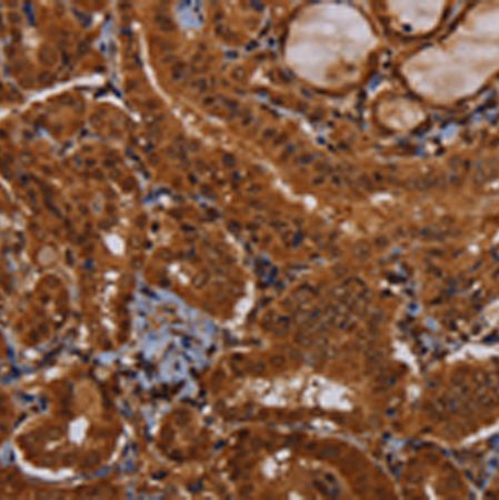 兔抗WDR83多克隆抗体