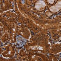 兔抗WDR83多克隆抗体