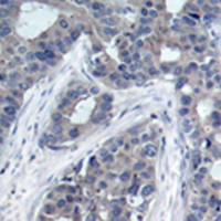 兔抗IRS1 (Phospho-Ser636) 多克隆抗体