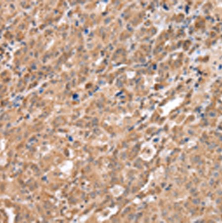 兔抗DDX58多克隆抗体