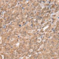 兔抗DDX58多克隆抗体