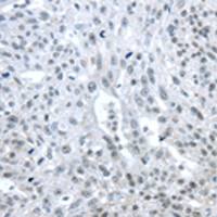 兔抗TRIM33多克隆抗体