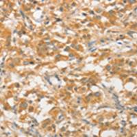 兔抗ATG5多克隆抗体