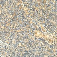 兔抗ASB6多克隆抗体