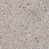 兔抗ARHGDIB多克隆抗体