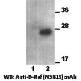 Anti BRaf(N581S) Mouse Monoclonal Antibody
