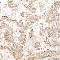 兔抗DHRS7多克隆抗体