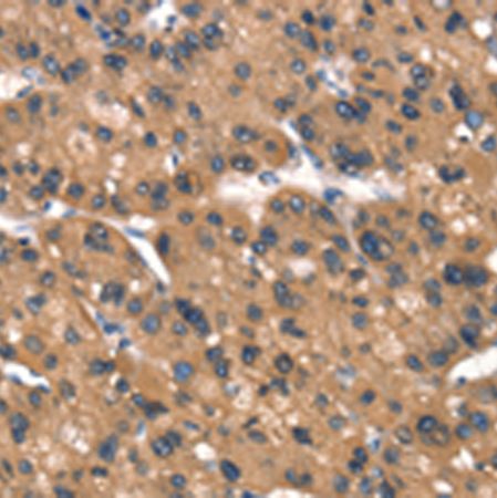 兔抗DAAM1多克隆抗体