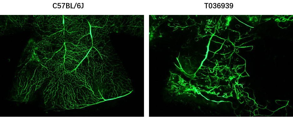 关注老年疾病:年龄相关性黄斑变性(AMD)