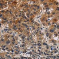 兔抗CLDN8多克隆抗体