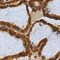 兔抗MCRS1多克隆抗体