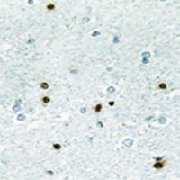 兔抗DCLK3多克隆抗体