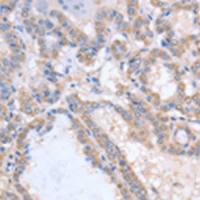 兔抗ACVR1C多克隆抗体