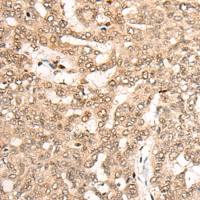 兔抗COPS7A多克隆抗体