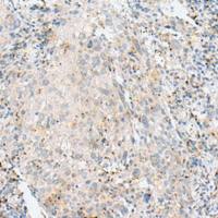 兔抗NSUN4多克隆抗体