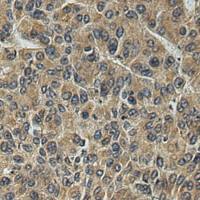 兔抗RWDD1多克隆抗体