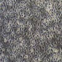 小鼠黑色素瘤带荧光素酶;B16luc