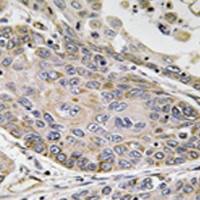 兔抗PLA2G4E多克隆抗体