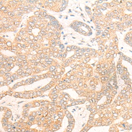 兔抗DCAF5多克隆抗体