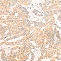 兔抗DCAF5多克隆抗体