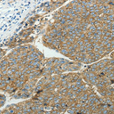 兔抗SLC16A1多克隆抗体