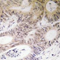 兔抗RPS6KA5(Ab-212) 多克隆抗体