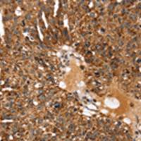 兔抗KCNH6多克隆抗体