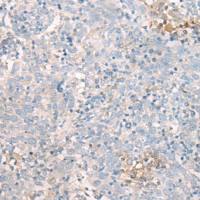 兔抗MBOAT7多克隆抗体