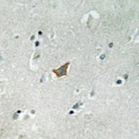 兔抗EPHA3/4/5(Phospho-Tyr779/833) 多克隆抗体