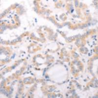 兔抗CIDEB多克隆抗体