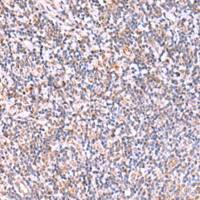 兔抗ITPKC多克隆抗