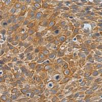 兔抗LPCAT2多克隆抗体