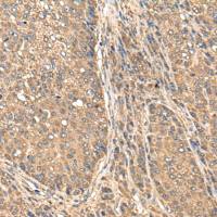 兔抗BAALC多克隆抗体