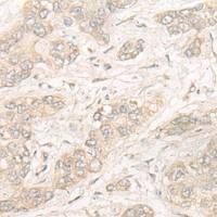 兔抗NOSIP多克隆抗体